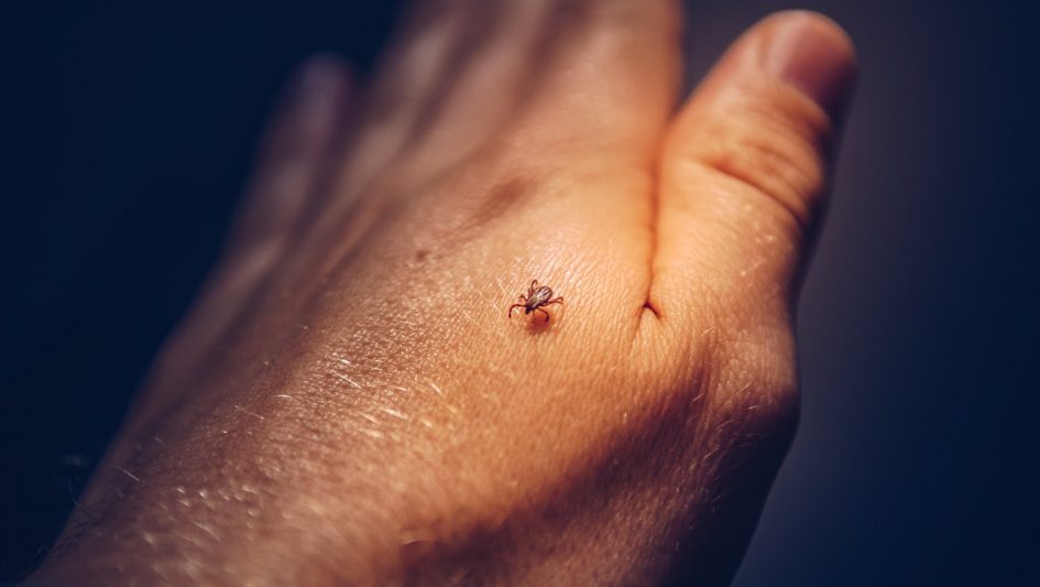tick crawling on human hand